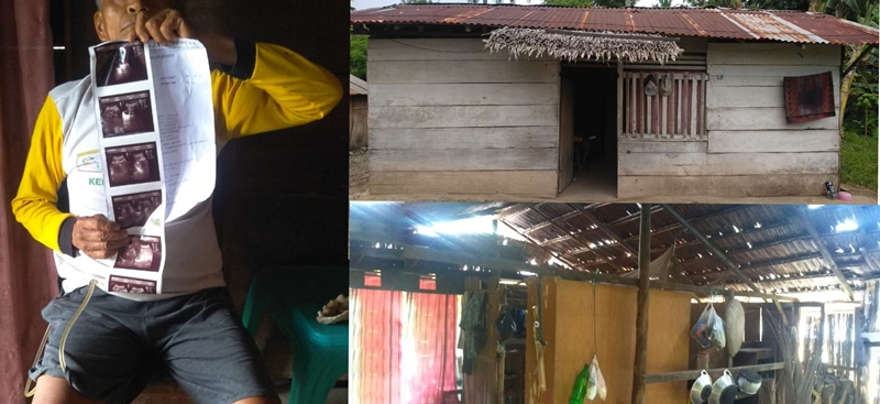 Hidup Berdampingan dengan Kateter, Ini Kisah Kakek Rahman Warga Desa Konarom Barat