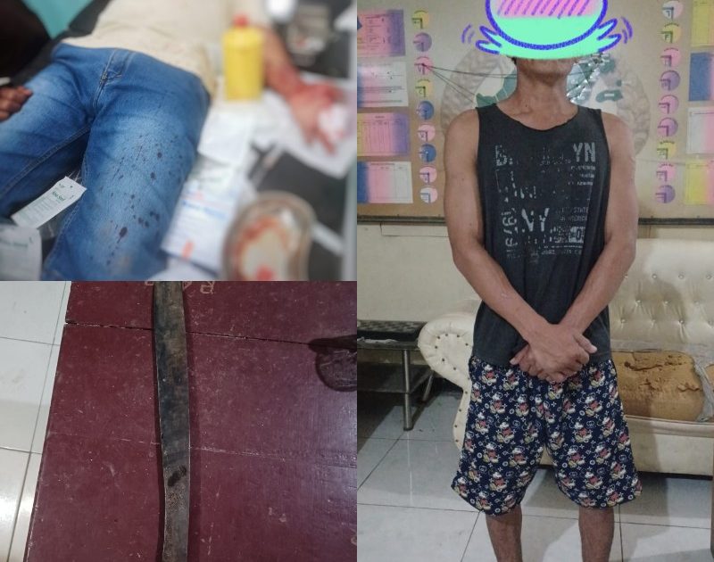 Sadis! Dua Jari Warga Buyat Selatan Putus Ditebas Orang Mabuk